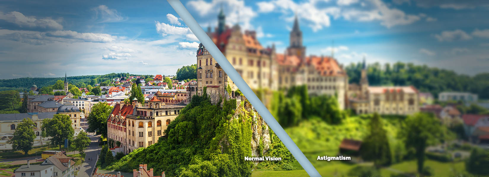 Astigmatism Treatment in Loveland