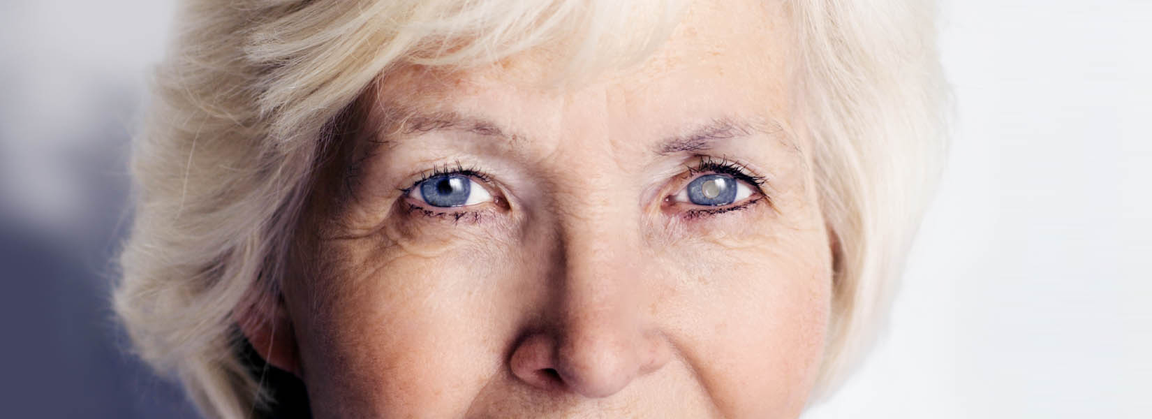 Cataract Surgery in Loveland